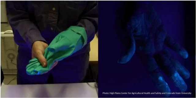 glove removal