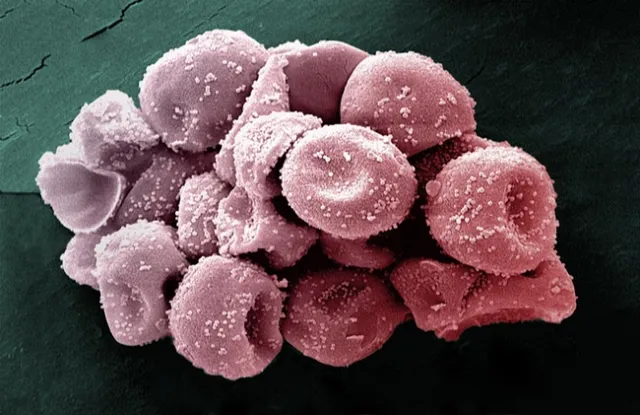 pollen grain