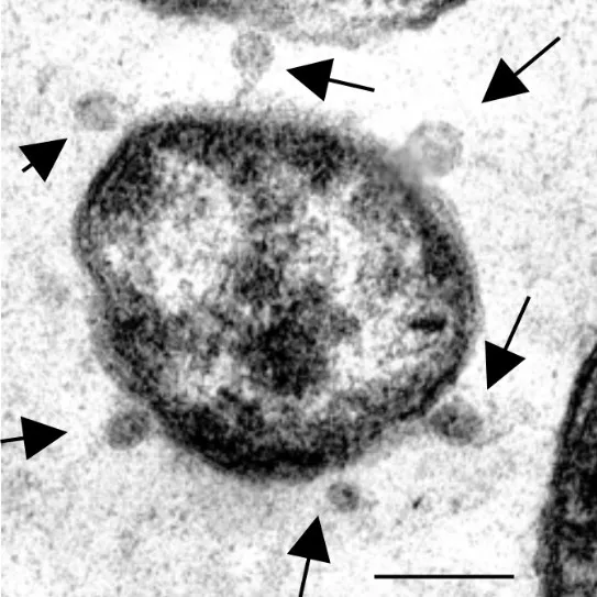HLB cytosol leakage