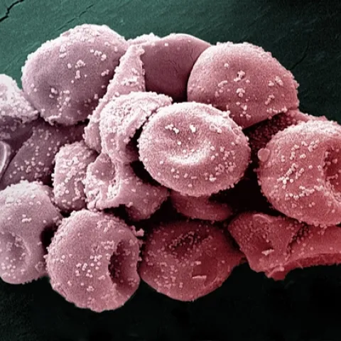 pollen grain