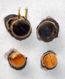 pruning fig 3