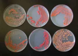 Yeast cultures at the Phaff Yeast Culture Collection.