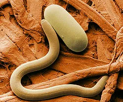 250px-Soybean_cyst_nematode_and_egg_SEM