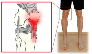 knee