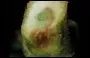 Fusarium Wilt